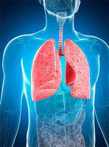 Пневмония - воспаление легочной ткани (Pneumonia-inflammation of the lung tissue)