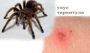 Укус тарантула фото (bite of a tarantula photo)