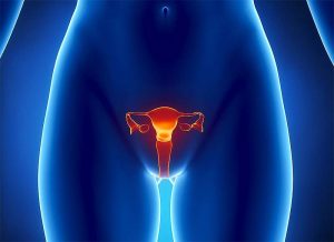 Эндоцервицит и эндометрит