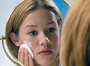 Угревая сыпь (acne)