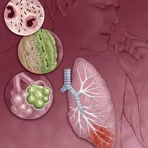 Лечение инфекционного больного