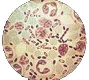 Кровяные инфекции