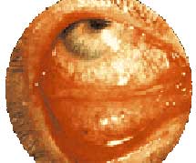 Хламидийный конъюнктивит