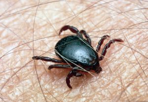 Клещевой энцефалит