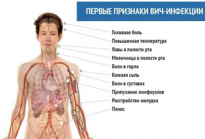 Признаки вич инфекции (signs of HIV infection)