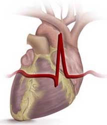 Что делать при аритмии