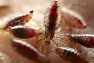 Как избавиться от вшей и гнид народными средствами