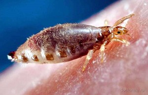 Педикулёз и его лечение в домашних условиях