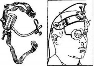 Диатермия глаза
