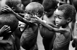 Квашиоркор - описание болезни