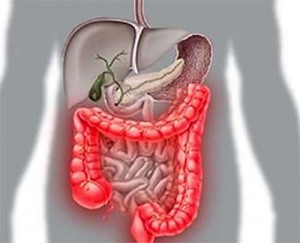 Язвенный колит неспецифический