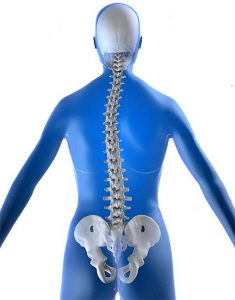 Как выглядит сколиоз