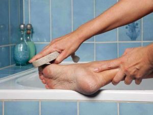 Народные советы по избавлению и лечению мозолей и натоптышей