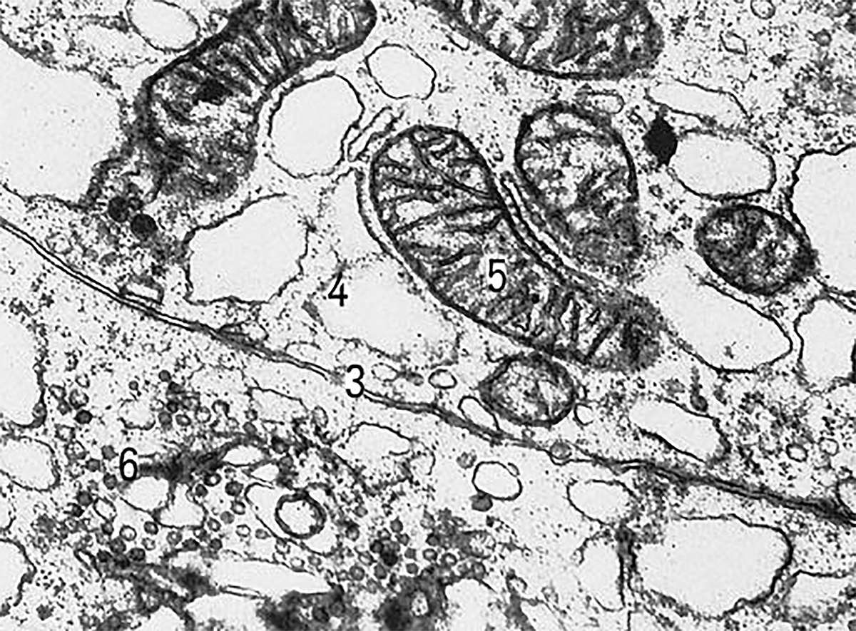 Участки двух клеток щитовидной железы крысы (увеличено в 30000 раз) (Plots of two rat thyroid cells (enlarged 30,000 times))