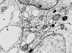 Клетки щитовидной железы крысы с включениями (Rat thyroid cells with inclusions)