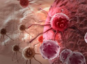 Злокачественные опухоли - картинка (Malignant tumor - picture)