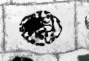 Анафаза мимитоза лука (Anaphase of mitosis onion)