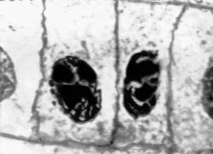 Интерфаза митоза лука (Interphase mitosis onion)