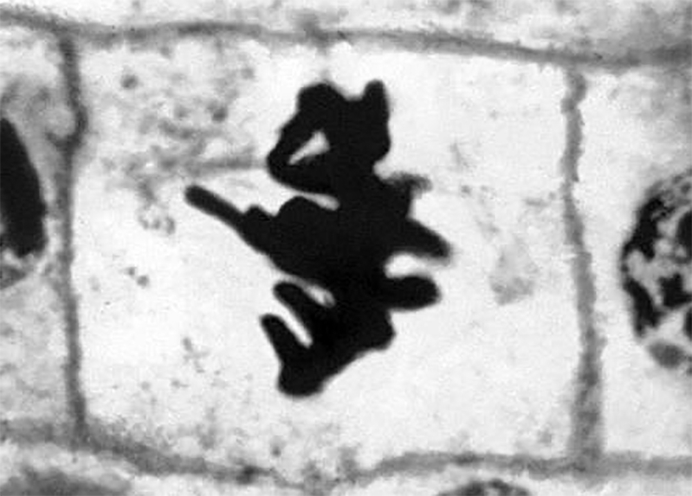 mitosis-cells-root-onion-metaphase | Сайт Здоровья