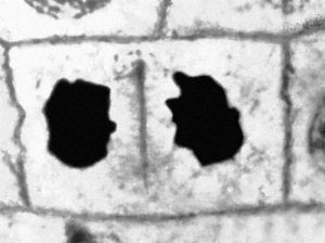 Прометафаза митоза в корешках лука (Prometaphase of mitosis in onion roots)